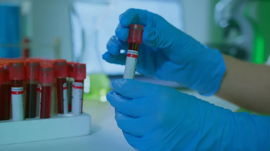 Breaking Down DNA DS Antibody Testing for Better Health Decisions