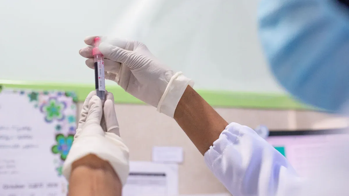 Testing for Anti-Ro Antibody
