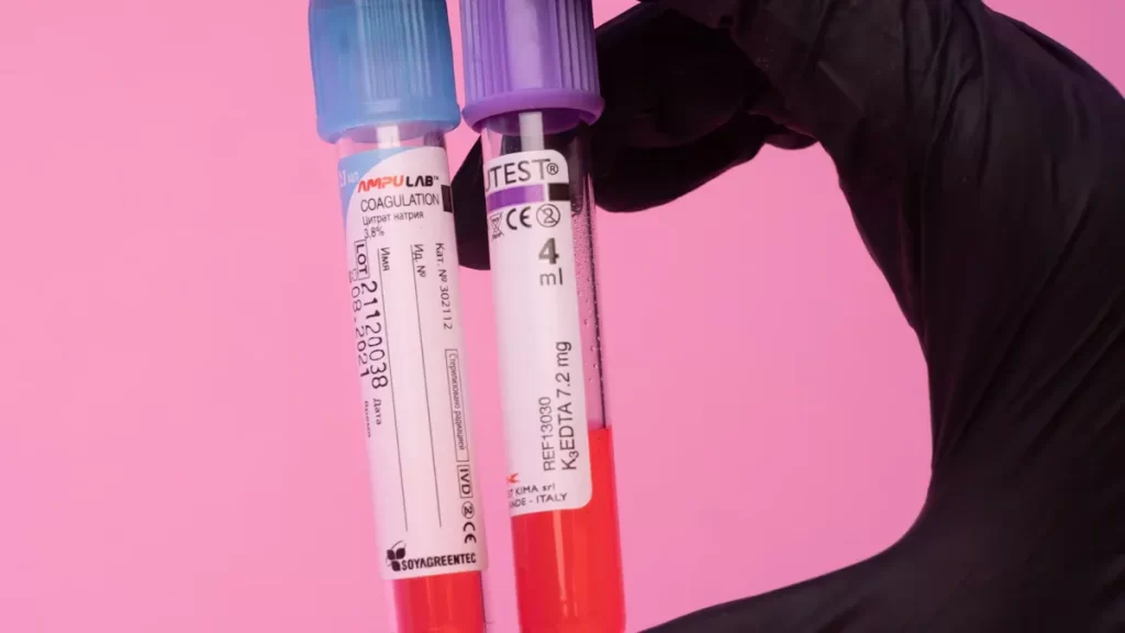 A Step-by-Step Guide to Detecting Anti-Smith Antibodies