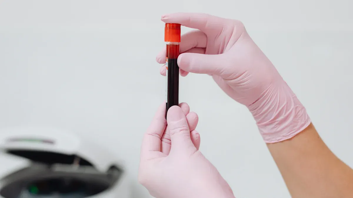 tTG-IgA Test for Celiac Disease
