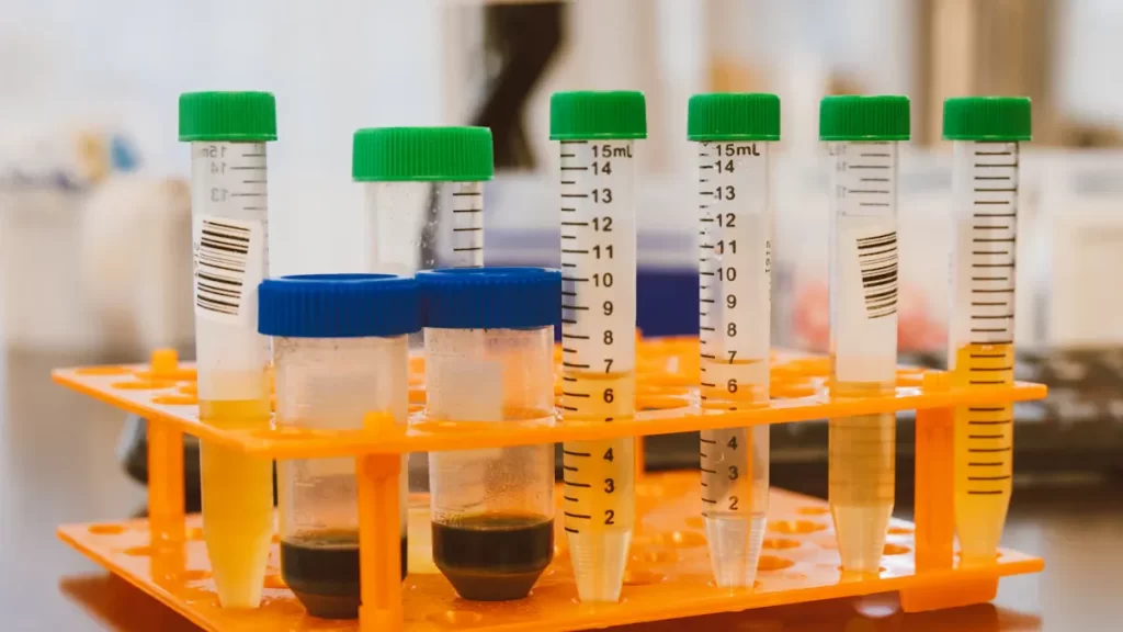 Exploring the Most Popular Test Tube Racks for Western Blotting