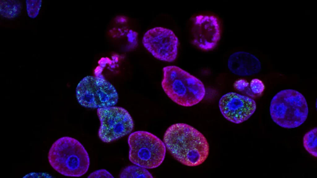 Centromere B Antibody Test and Its Role in Modern Medicine
