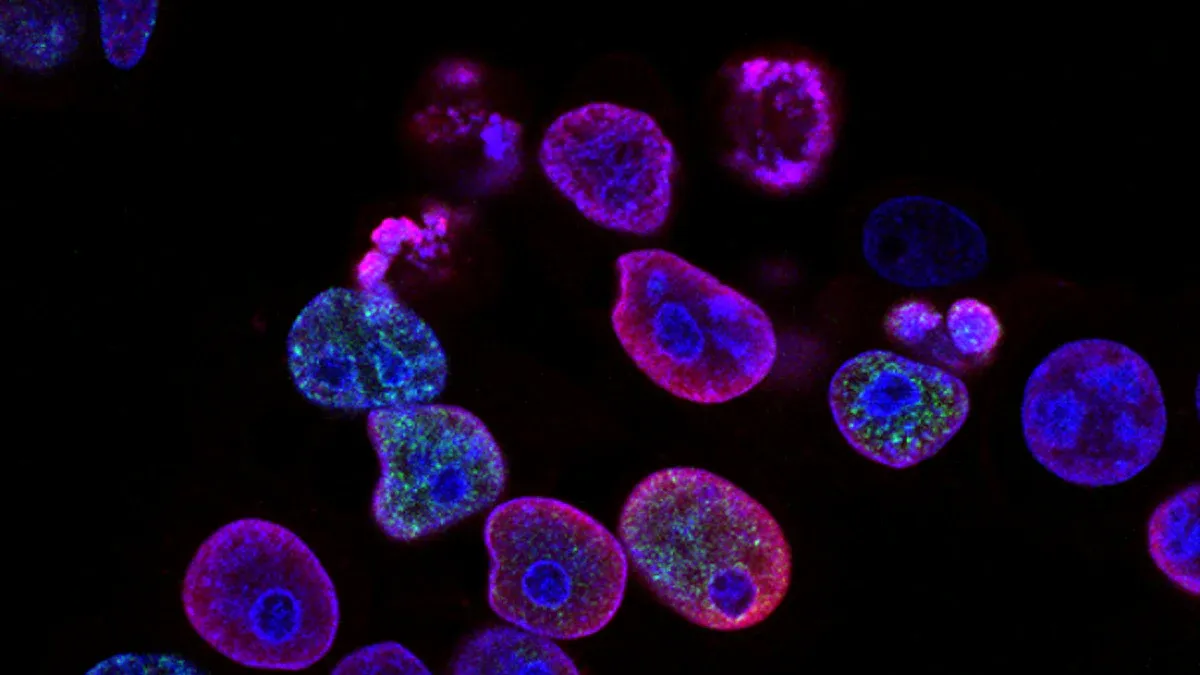 Centromere B Antibody Test and Its Role in Modern Medicine