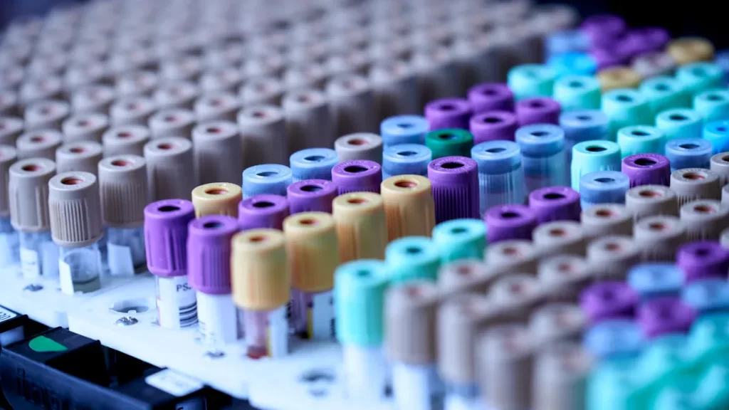Your Guide to Hep B Surface Antibody Reactive Results in 2025