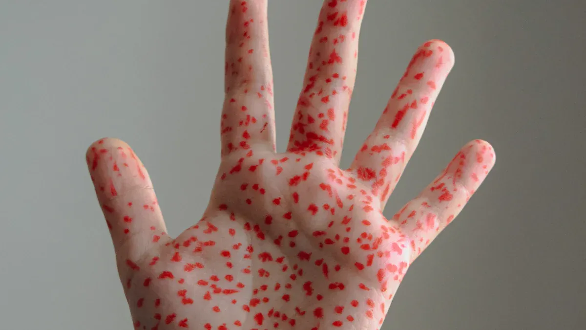 Understanding Rubella Virus IgG Ab for Immunity and Pregnancy