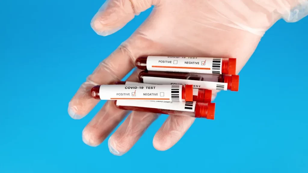 What Anti Double Stranded DNA Antibody Results Mean for Your Health