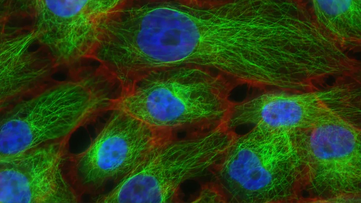 A Guide to Anti Centromere Antibody and Its Role in Autoimmune Disorders