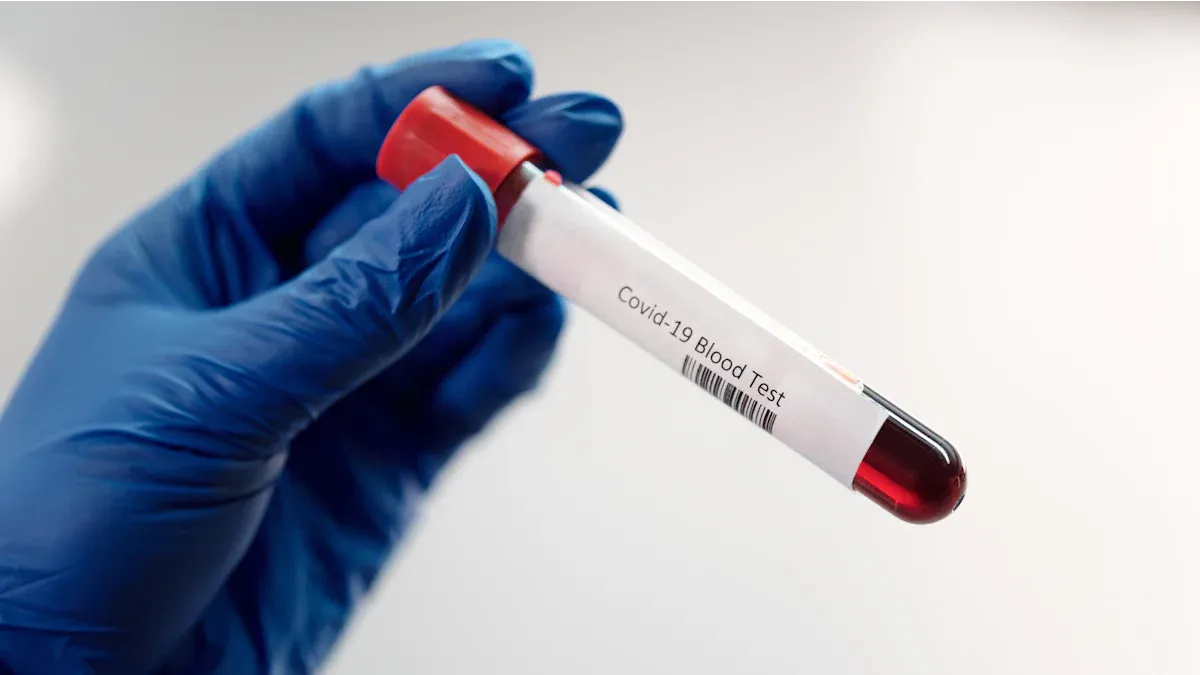 SSA Antibody in Autoimmune Diagnosis