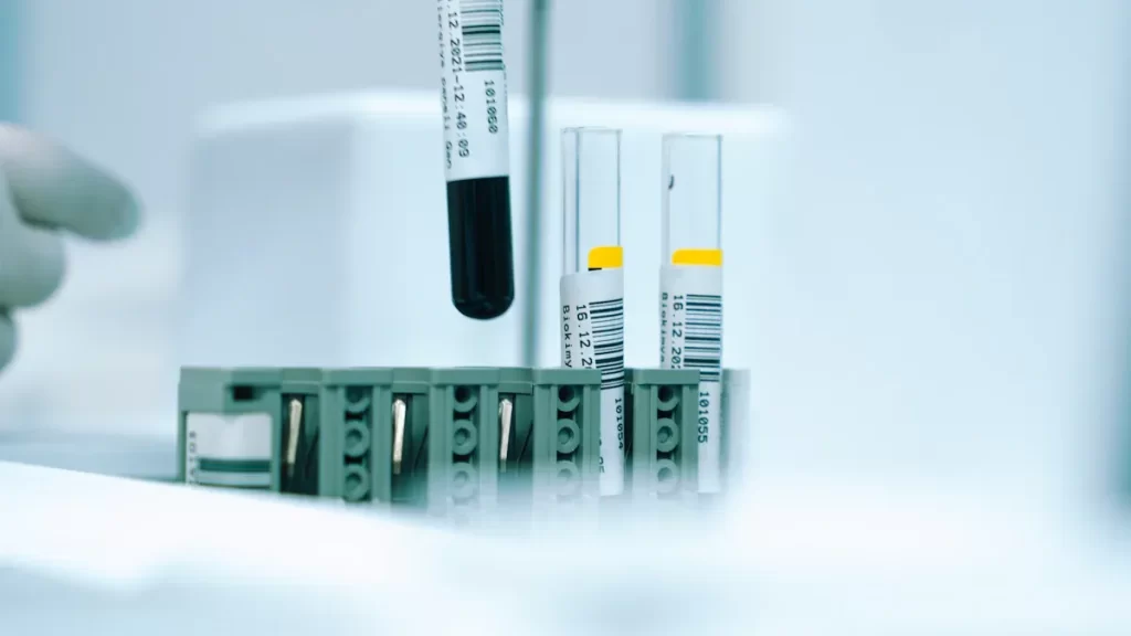 Understanding the Role of C Antibody IgG in HCV Testing